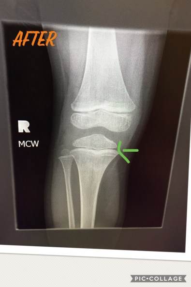 DA8FB956-9526-4021-966B-95BF85E03245